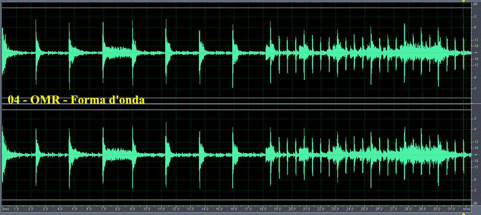 04 - OMR - Forma d'onda.gif