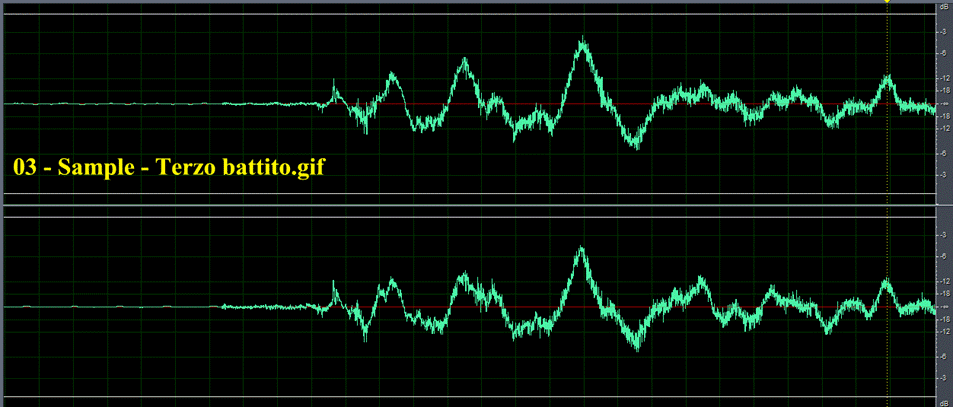 03 - Sample - Terzo battito.gif