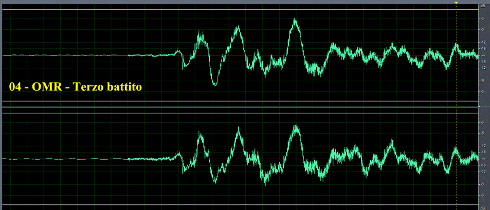 04 - OMR - Terzo battito.gif